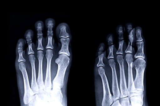 The Importance of Biomechanics in Podiatry