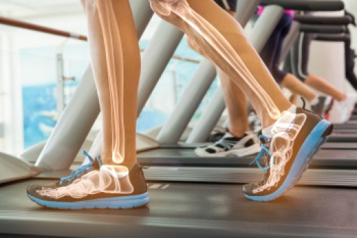 Comparing Treadmill and Outdoor Running