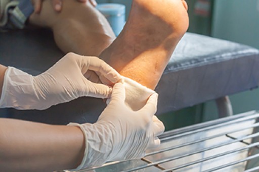 Puncture Wounds on the Foot