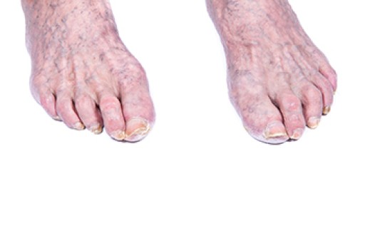 Effective Foot Care Tips for Seniors