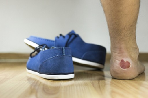 Infected Blisters