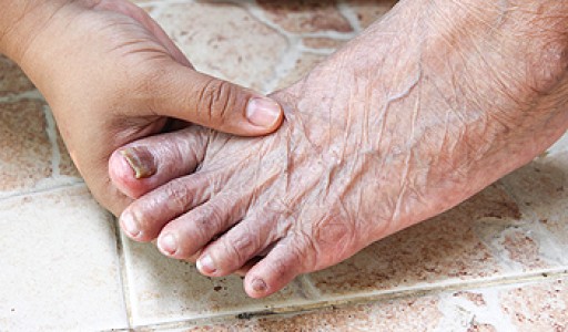 Reduced Fat Pads May Lead To Unwanted Foot Conditions
